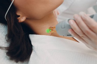 Lazer epilasyon ve kozmetik. Saç kaldırma kozmetik prosedür. Boyun ve kozmetik lazer epilasyon. Kozmetik ve Spa konsept.