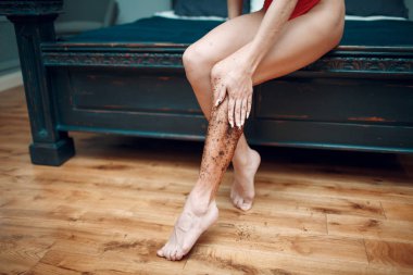 Bodur bacaklar için kullanan kadın