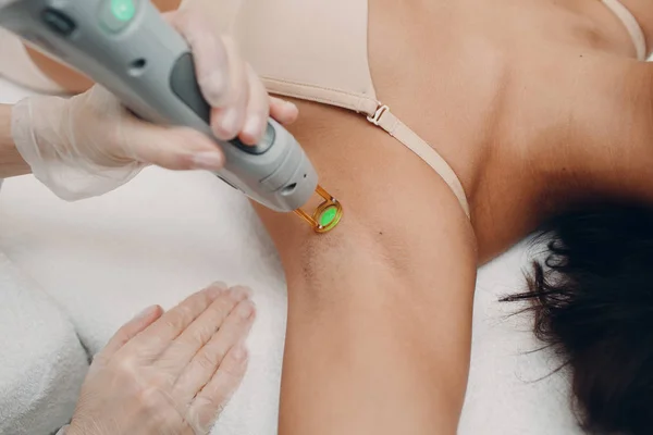 Depilação Laser Axilas Cosmetologia Procedimento Cosmetologia Remoção Cabelo Epilação Laser — Fotografia de Stock