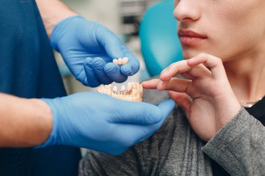 Diş hekimliği. Diş hekimi hastaya implantlar gösteriyor. Diş Kliniği.