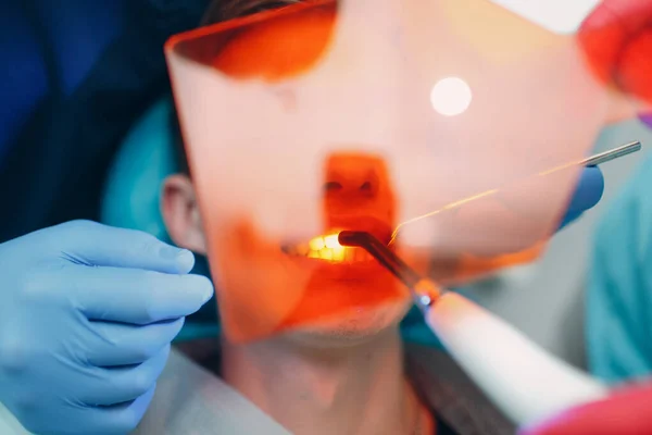 歯医者と患者 ライト硬化シール Uvデンタルランプとオレンジはガラスを保護します 歯科用充填剤 — ストック写真