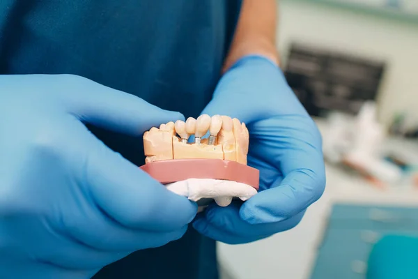 歯科医は患者にインプラントを示します 歯科医院 — ストック写真