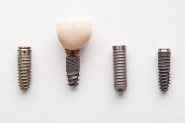 İnsan dişinin diş implantı ve beyaz arka plandaki parçaları.