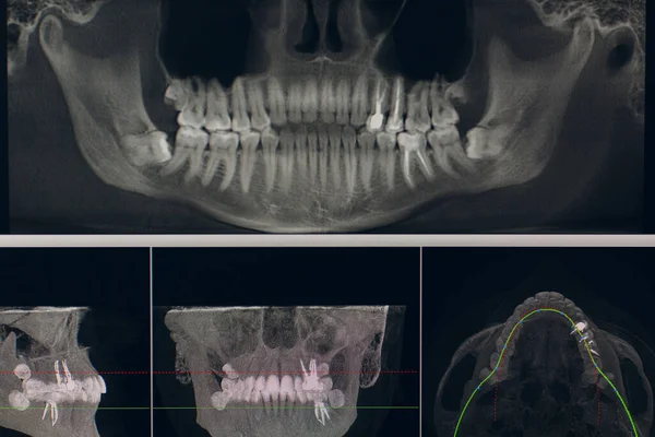 X-ray of the jaw in the dental clinic