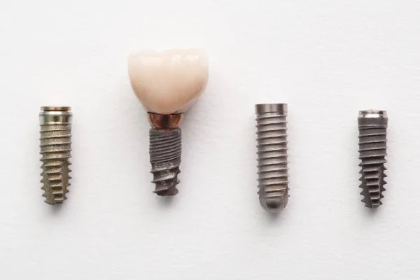 Οδοντιατρικό Εμφύτευμα Ανθρώπινου Δοντιού Και Των Μερών Του Λευκό Φόντο — Φωτογραφία Αρχείου
