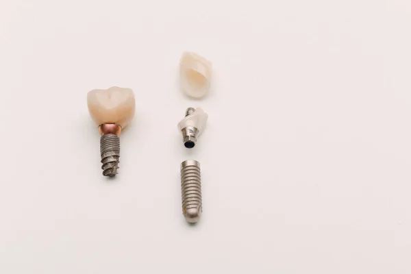 Implante Dentário Dente Humano Suas Partes Sobre Fundo Branco — Fotografia de Stock