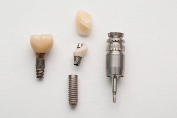 Implant Stomatologiczny Ludzkiego Zęba Jego Części Białym Tle — Zdjęcie stockowe