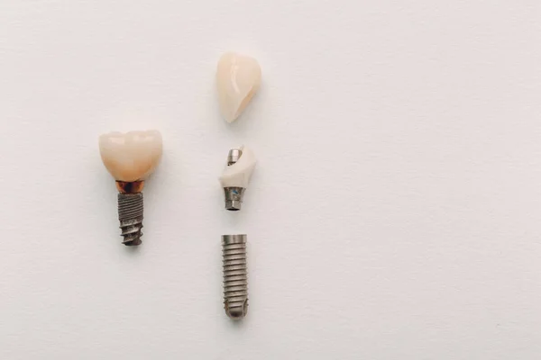 Implante Dentário Dente Humano Suas Partes Sobre Fundo Branco — Fotografia de Stock