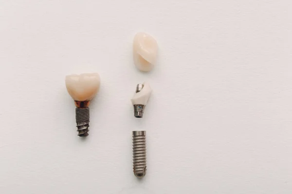 Implante Dentário Dente Humano Suas Partes Sobre Fundo Branco — Fotografia de Stock