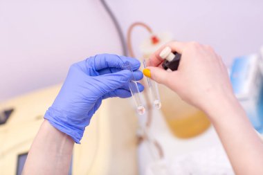 Laboratuvardaki laboratuvar asistanı elinde kan ve plazmayla test tüpü tutuyor ve analiz yapıyor..