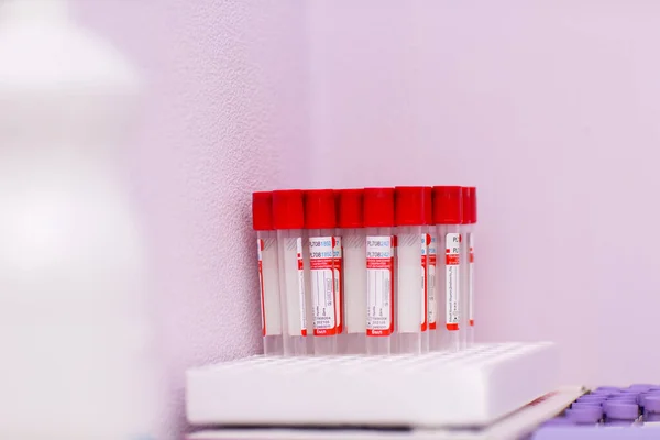 Tıbbi Laboratuarda Kan Testi Tüpleri — Stok fotoğraf