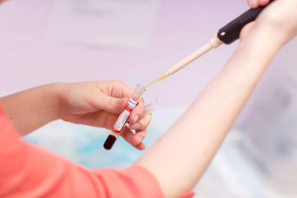Tıp Laboratuarındaki Laboratuvar Asistanı Test Tüpü Tutuyor Kan Plazmayı Ayırıyor — Stok fotoğraf