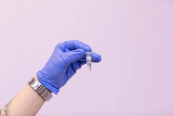 Tıp Laboratuarındaki Laboratuvar Asistanı Elinde Plazmayla Test Tüpü Tutuyor Analiz — Stok fotoğraf