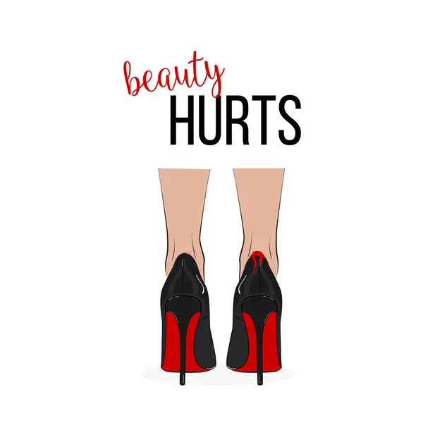 Fashion print Beauty hurts with legs in high heels. Vector fashionable night out woman illustration. Red sole trendy pumps with blood on the back Painful glamour lifestyle — Stock Vector