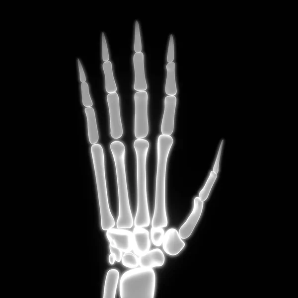 Kroppsliga Skelettsmärtor Anatomi Palm Hand — Stockfoto