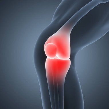 İnsan Vücut Kemiği Eklem Ağrısı (Diz Eklemleri). 3D - Görüntü