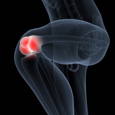 İnsan Vücut Kemiği Eklem Ağrısı (Diz Eklemleri). 3D - Görüntü