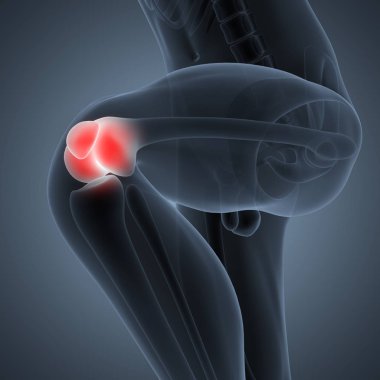 İnsan Vücut Kemiği Eklem Ağrısı (Diz Eklemleri). 3D - Görüntü