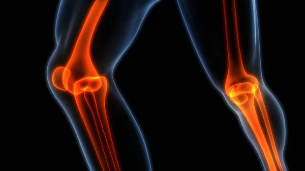 miért lehet fájdalom a térdízületben ayurveda artritisz artrózis kezelése
