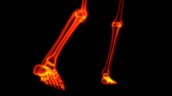 Huesos Del Cuerpo Humano Dolores Articulares Anatomía Articulaciones Pies Piernas —  Fotos de Stock