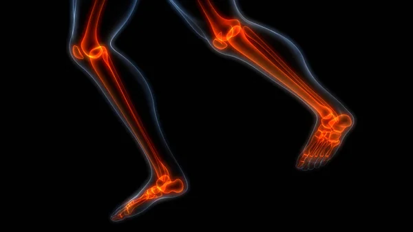 Bolest Kloubů Kostí Lidského Těla Klouby Nohou Kosti Ilustrace — Stock fotografie