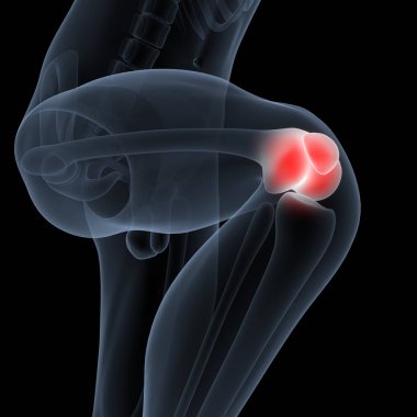 İnsan Vücut Kemiği Eklem Ağrısı (Diz Eklemleri). 3D - Görüntü