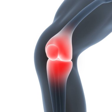 İnsan Vücut Kemiği Eklem Ağrısı (Diz Eklemleri). 3D - Görüntü