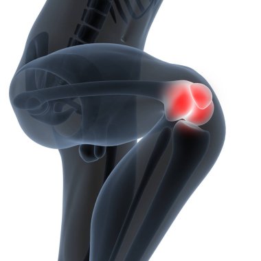 İnsan Vücut Kemiği Eklem Ağrısı (Diz Eklemleri). 3D - Görüntü