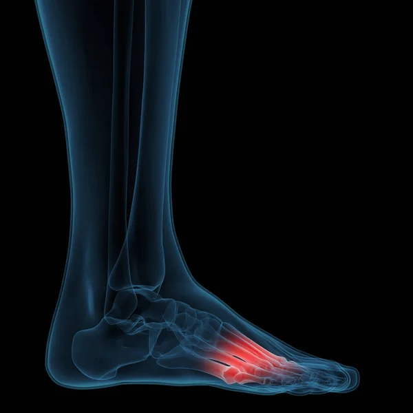 人体骨関節痛 脚関節解剖学 イラスト — ストック写真