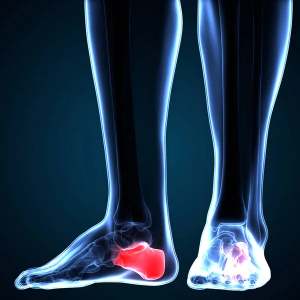 人体骨関節痛 足関節と骨 イラスト — ストック写真
