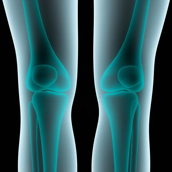 Human Body Bones Joint Pains Anatomy (Legs and Feet Joints). 3D - Illustration