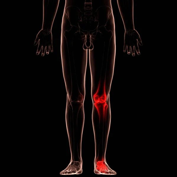 Анатомия Боли Костном Суставе Человека Коленный Сустав Иллюстрация — стоковое фото