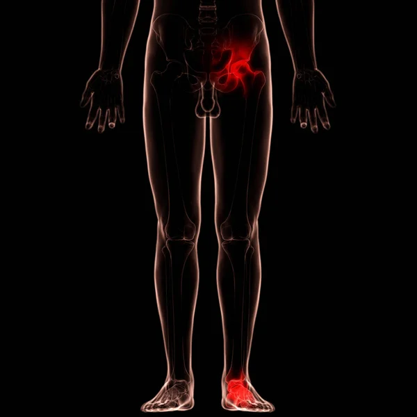 Anatomía Dolores Articulares Óseos Del Cuerpo Humano Ilustración — Foto de Stock