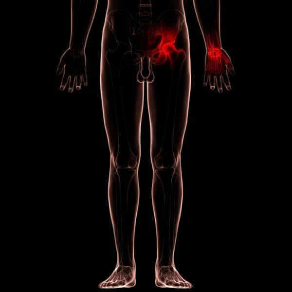 Anatomía Dolores Articulares Óseos Del Cuerpo Humano Ilustración — Foto de Stock