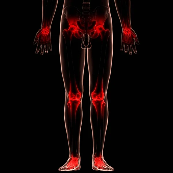 Anatomia Das Dores Nas Articulações Ósseas Corpo Humano Articulações Joelho — Fotografia de Stock