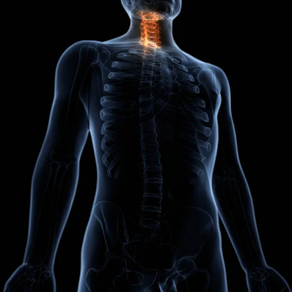 脊髓是人体骨骼解剖的一部分 颈椎侧视 — 图库照片