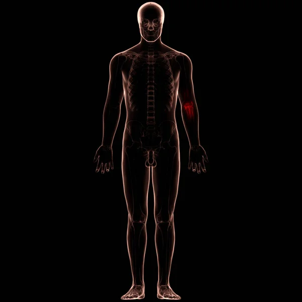 Ludzkie Ciało Bóle Stawów Anatomia Ilustracja — Zdjęcie stockowe