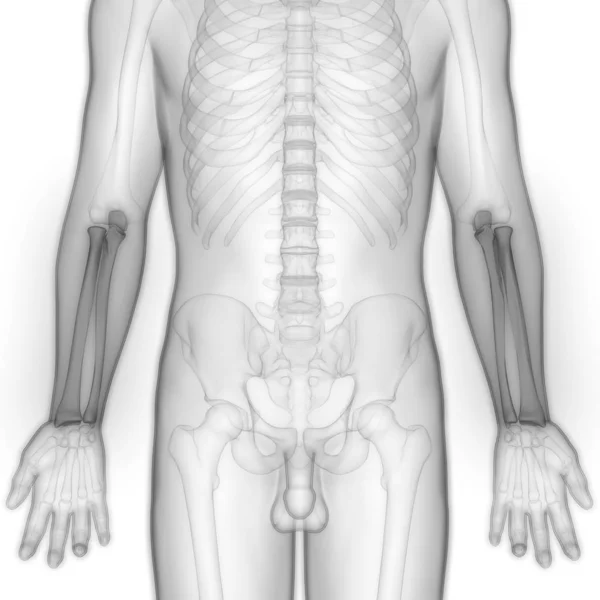 Dores Nas Articulações Corpo Humano Articulações Das Mãos Ilustração — Fotografia de Stock