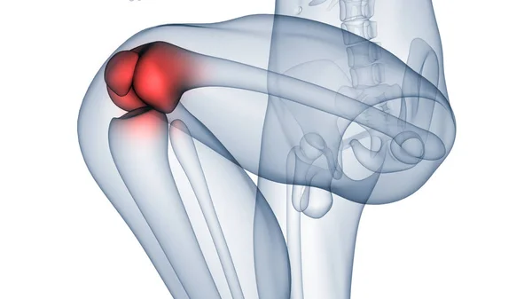 人骨関節痛 膝関節痛 イラスト — ストック写真