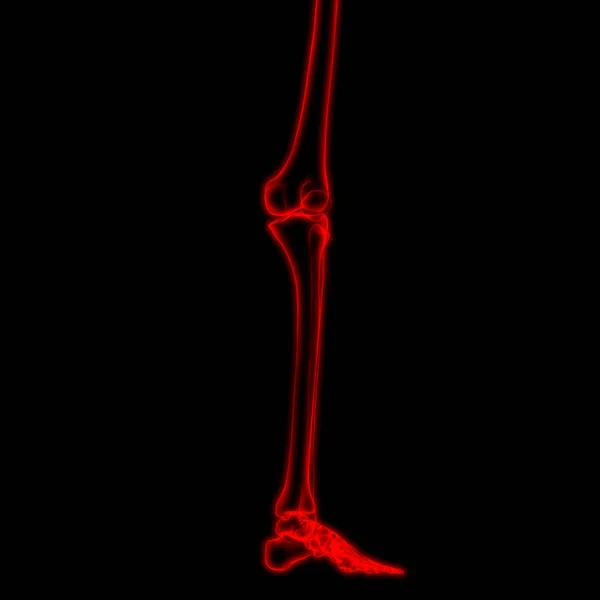 Knochengelenkschmerzen Des Menschlichen Körpers Beingelenk Illustration — Stockfoto