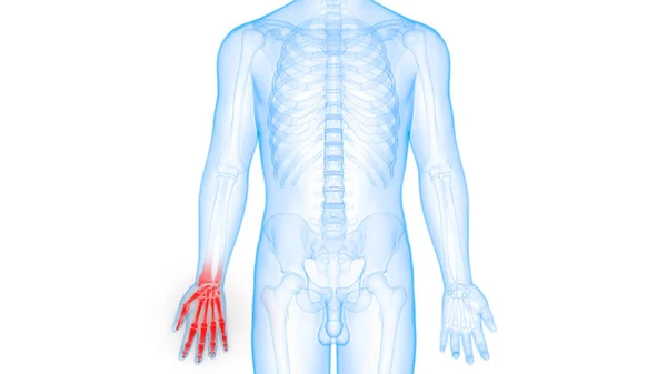 Анатомия Костей Рук Скелета Человека — стоковое фото
