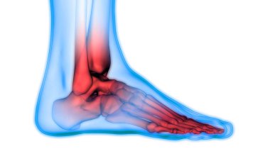 İnsan Vücut Kemiği Eklem Ağrısı (Bacak Eklemleri) 3D - Görüntü