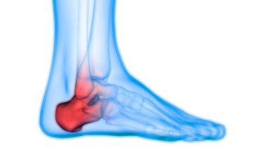 İnsan Vücut Kemiği Eklem Ağrısı (Bacak Eklemleri) 3D - Görüntü