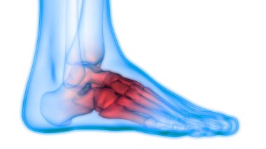 İnsan Vücut Kemiği Eklem Ağrısı (Bacak Eklemleri) 3D - Görüntü