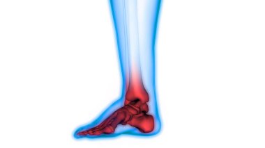 İnsan Vücut Kemiği Eklem Ağrısı (Bacak Eklemleri Anatomisi). 3D - Görüntü