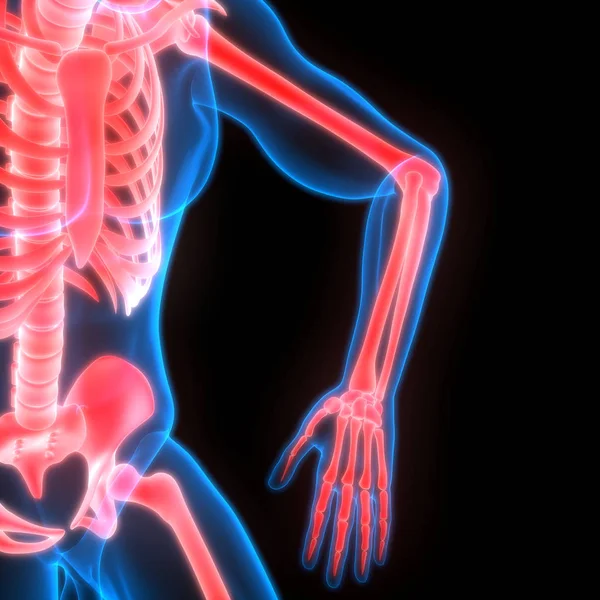 Human Body Bone Joint Pains Anatomy Handgewricht Illustratie — Stockfoto