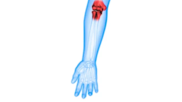 Dores Nas Articulações Ósseas Corpo Humano Articulação Mão Ilustração — Fotografia de Stock