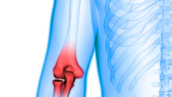 Dores Nas Articulações Ósseas Corpo Humano Articulação Mão Ilustração — Fotografia de Stock