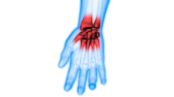 Douleurs Articulaires Osseuses Corps Humain Articulation Des Mains Illustration — Photo