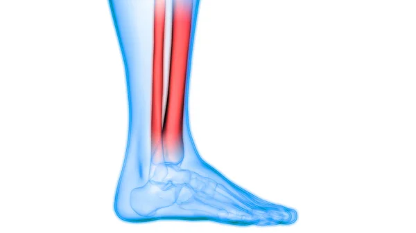 Human Body Bone Joint Pains Illustration — стокове фото